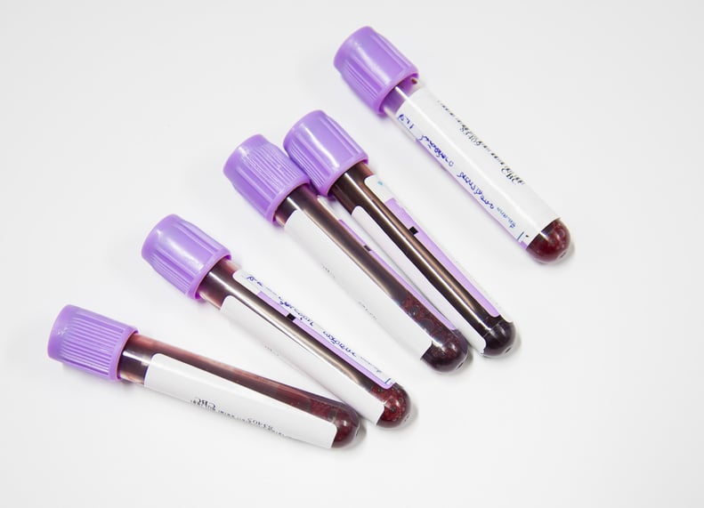 Blood test tube in laboratory.