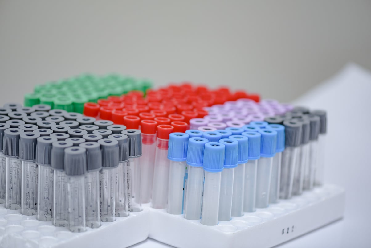Blood collection tubes in the laboratory